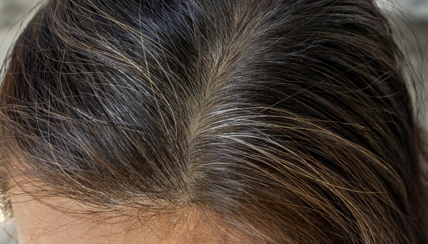 Latest ingredient round-up: from plant-derived collagen to an anti-grey hair  formula | in-cosmetics Connect