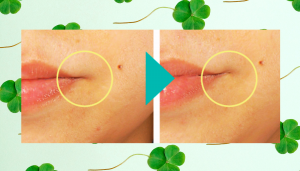 Four-leaf clover extract
