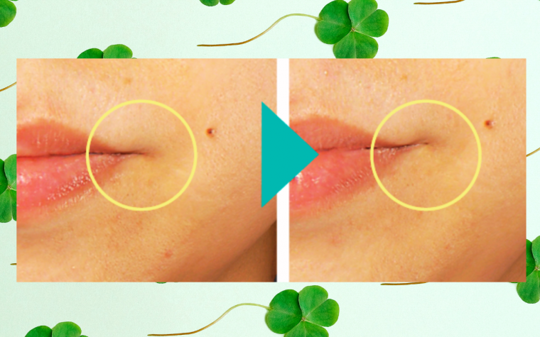 Four-leaf clover extract